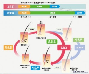 髪の毛の一生のヘアサイクル