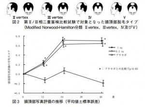 プロペシアの発毛は6ヵ月必要