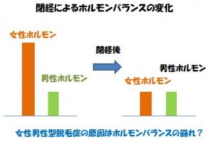 女性男性型脱毛症の原因