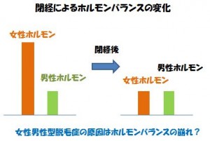 女性男性型脱毛症の原因