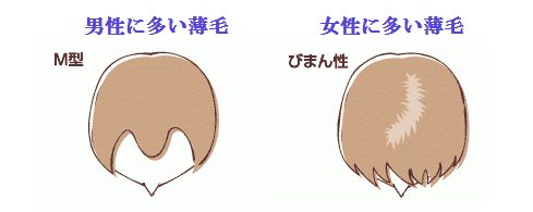 びまん性脱毛症は女性の薄毛の特徴