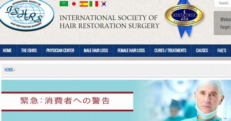 国際毛髪学会が自毛移植へ警告