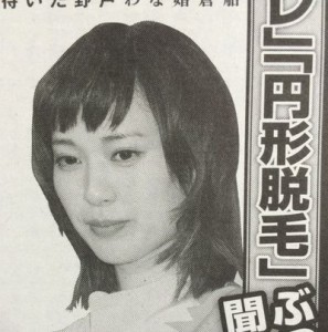 戸田恵梨香が円形脱毛症