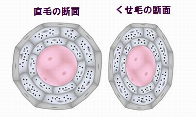 くせ毛の原因