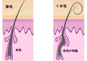 くせ毛と直毛の比較