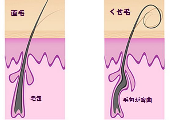 髪の毛 ちん げ