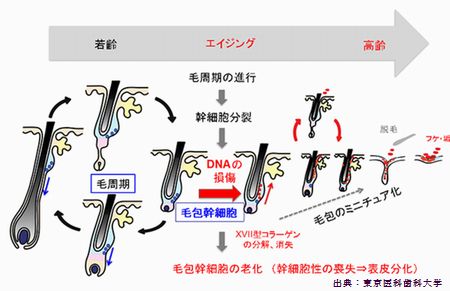 薄毛の原因