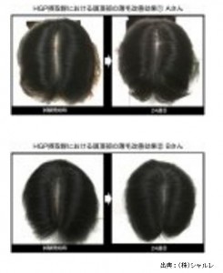 シャルレがプレスリリースしたタマゴ由来の新規育毛サプリメントを紹介します