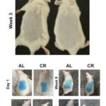 断食ダイエットには育毛効果がある