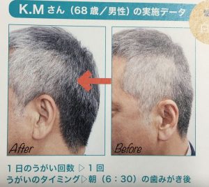 白髪がや薄毛が治る簡単な白ごまうがいのやり方