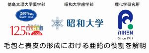 亜鉛が薄毛に効果がある理由を徳島文理大学らが解明