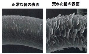 枝毛予防にはキャサリン妃のように髪を短く切った方が良いかもしれない