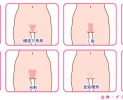 若い女性の脱毛する理由はムレ