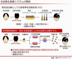 理研と京セラが頭髪の再生医療研究を開始した