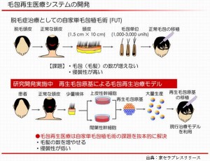 京セラは理研と頭髪の再生医療を開始し2020年の実用化を目指す