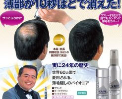 スーパーミリオンヘアーの増毛ビデオを見たら驚きます