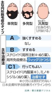 円形脱毛症が軽度なら治さなくても自然に治る可能性がある