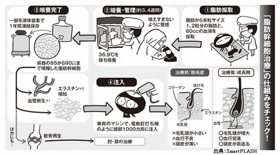 薄毛を治すアヴェニューセルクリニックの再生医療は科学的根拠があります