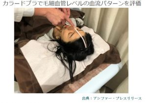 女性の薄毛の原因と頭皮の血流低下の関係