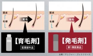 90%のヒトは育毛剤と発毛剤の違いを知らない