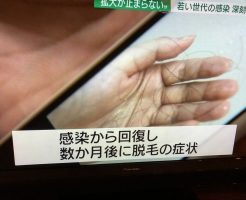 コロナ脱毛の無料相談