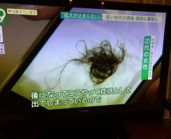 新型コロナの後遺症は休止期脱毛